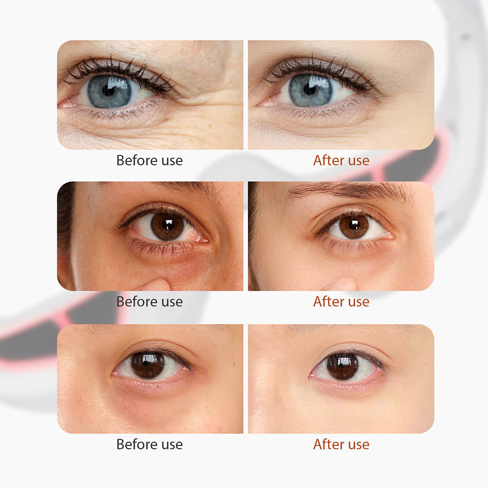 Novalight™ EyeGlow Pro - Travel Edition