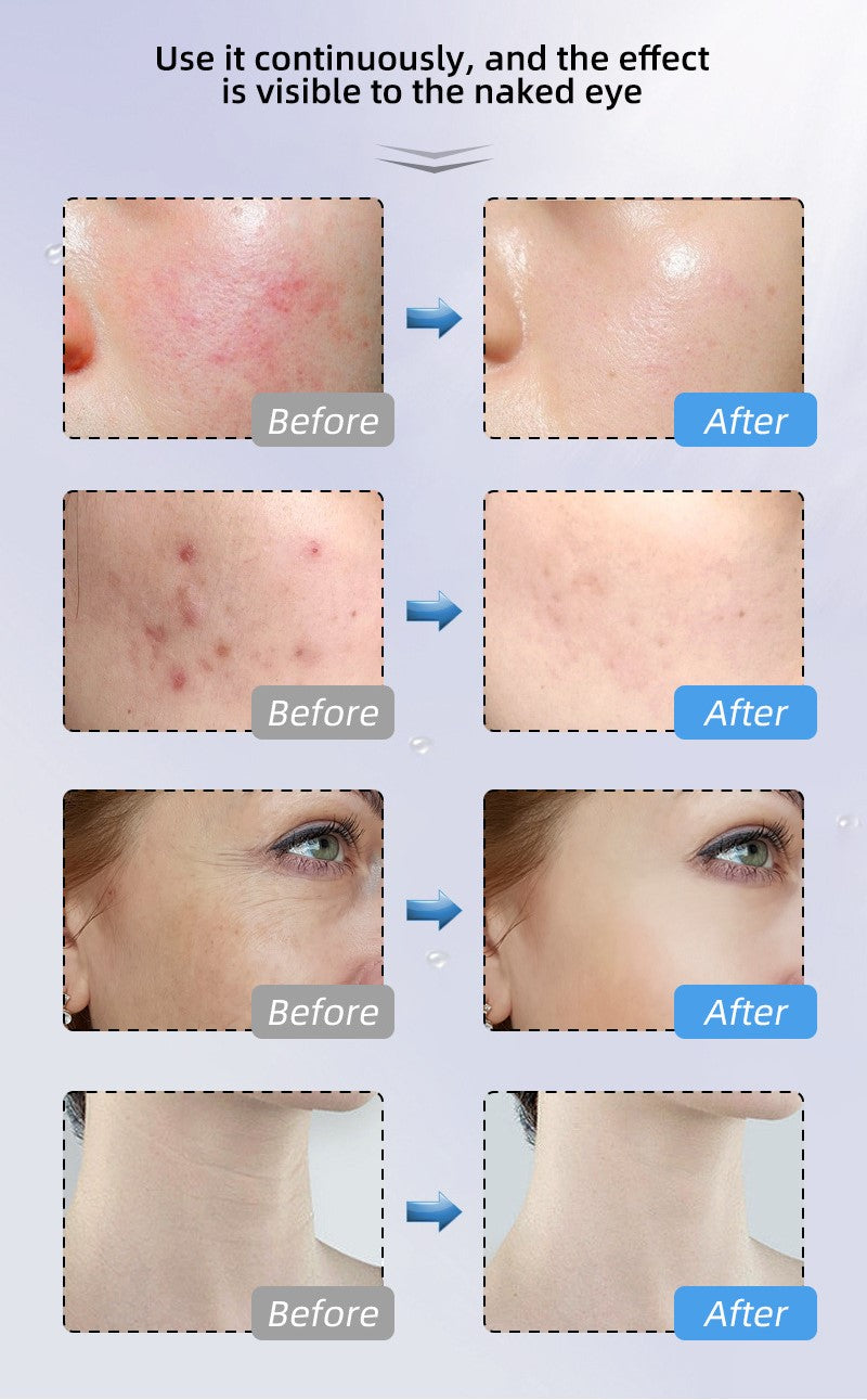 Novalight Pro LED Mask 2.0