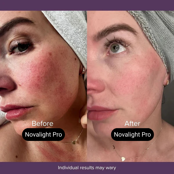 Novalight Pro LED Mask