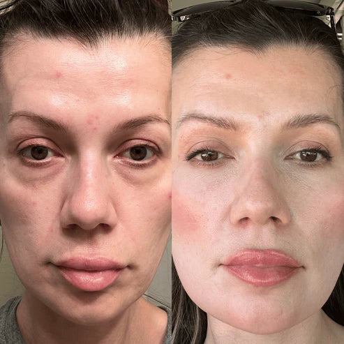 RevitalEyes™ Under-Eye Red Light Therapy
